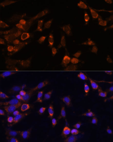 Anti-PSMB7 Antibody (CAB14771)