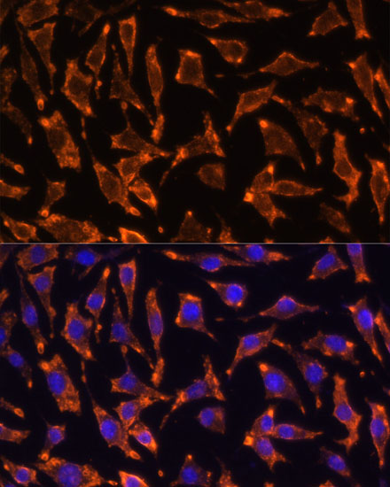 Anti-TNFRSF11A Antibody (CAB13382)