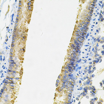 Anti-ACSS2 Antibody (CAB13596)