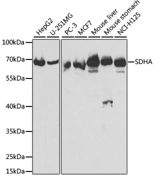 Anti-SDHA Antibody (CAB2594)