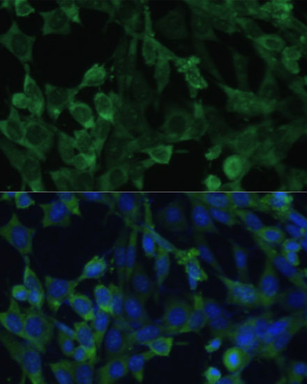 Anti-EIF1AX Antibody (CAB5917)