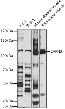 Anti-CAPN3 Antibody (CAB1893)
