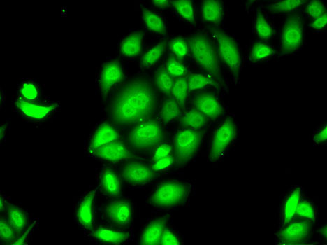 Anti-SPDEF Antibody (CAB14114)