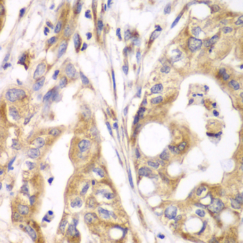 Anti-TXNRD2 Antibody (CAB5490)