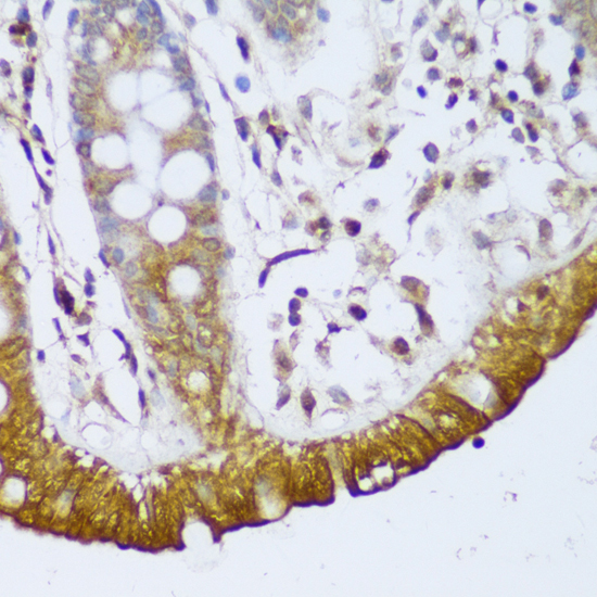 Anti-GCC2 Antibody (CAB13814)