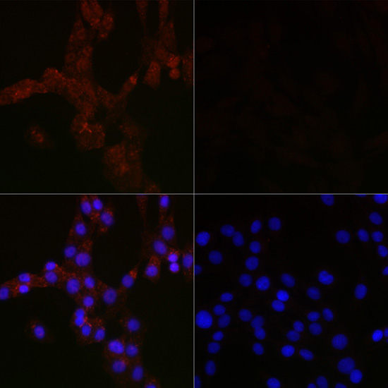 Anti-MAP1LC3B Mouse Monoclonal Antibody (CAB17424)