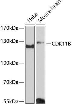 Anti-CDK11B Antibody (CAB12830)
