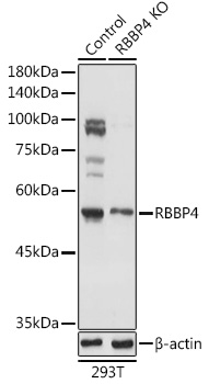 Anti-RBBP4 Antibody [KO Validated] (CAB13934)