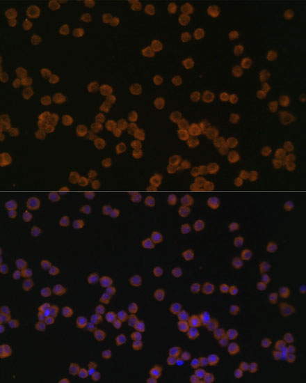 Anti-YKL-40 / CHI3L1 Antibody (CAB3166)