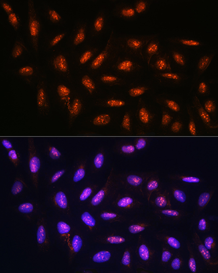 Anti-FANCD2 Antibody (CAB2072)