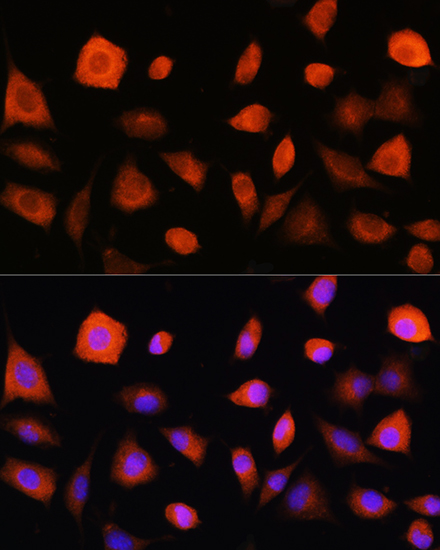 Anti-EIF2B5 Antibody (CAB10263)