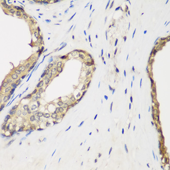 Anti-METTL7A Polyclonal Antibody (CAB8201)