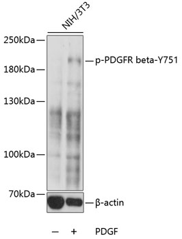 Anti-Phospho-PDGFRb-Y751 Antibody (CABP0493)