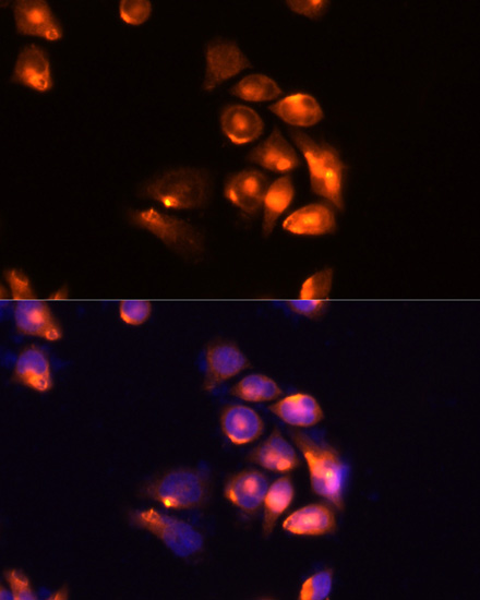 Anti-TIM-3/HAVCR2 Antibody (CAB13443)