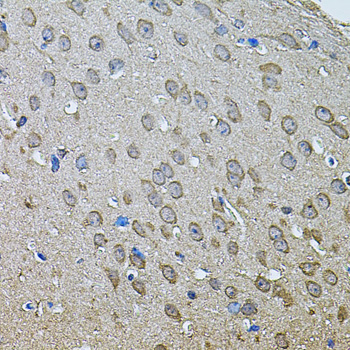 Anti-ANXA8L2 Antibody (CAB7641)