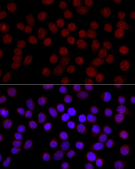 Anti-IKKAlpha Antibody (CAB0423)