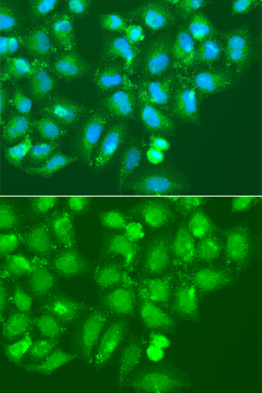 Anti-AMY2B Antibody (CAB14222)