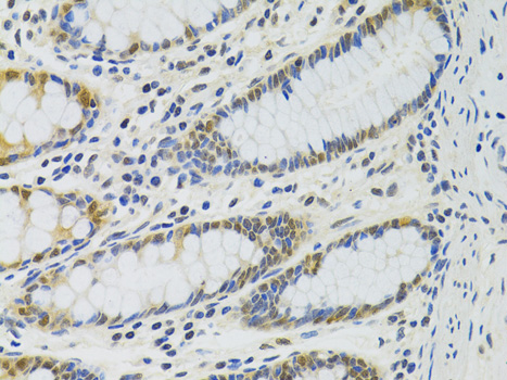 Anti-PPP4C Antibody (CAB2109)