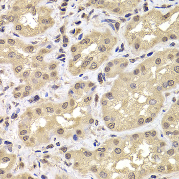 Anti-PSMD12 Antibody (CAB6708)