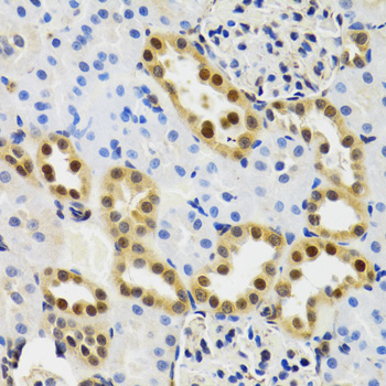 Anti-SUMO2 Antibody (CAB2486)