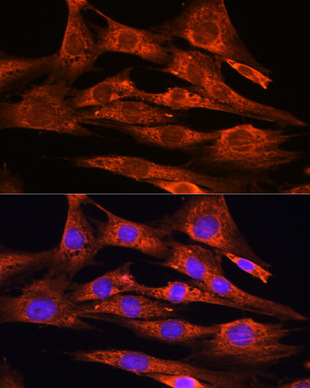 Anti-FSTL1 Antibody (CAB15789)