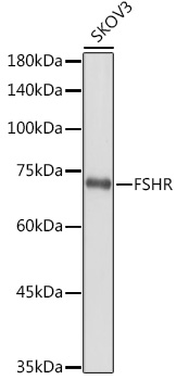 Anti-FSHR Antibody (CAB1480)