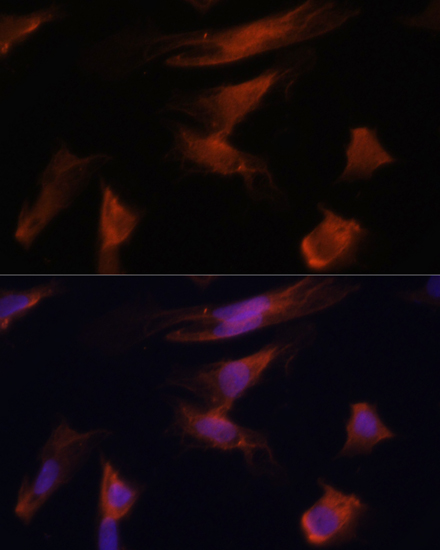 Anti-ADA Antibody (CAB13910)