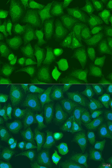 Anti-CHD1 Antibody (CAB15038)