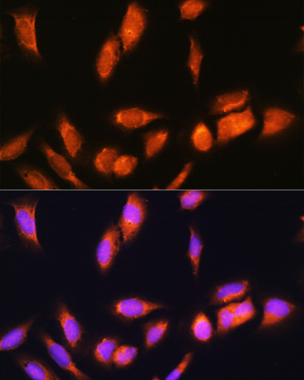 Anti-SCYL2 Antibody (CAB13178)