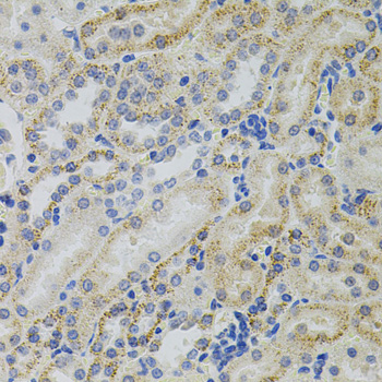 Anti-CRHR2 Antibody (CAB7659)