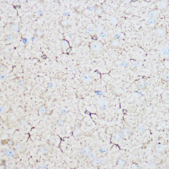 Anti-ALDOC Antibody (CAB11618)