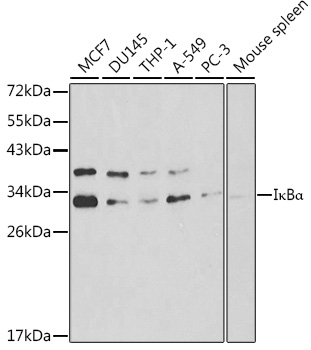 Anti-IkBAlpha Antibody (CAB11165)