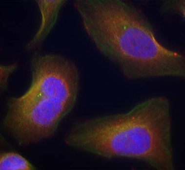 Anti-Phospho-PRKCQ-S676 Antibody (CABP0260)