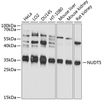 Anti-NUDT5 Antibody (CAB10493)