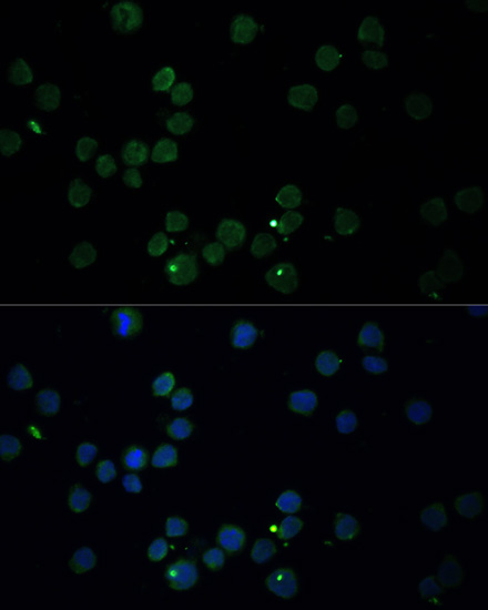 Anti-CHAT Antibody (CAB13244)