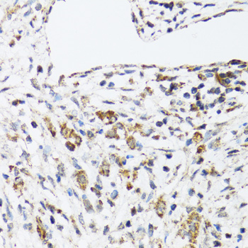 Anti-DHRS2 Antibody (CAB6446)