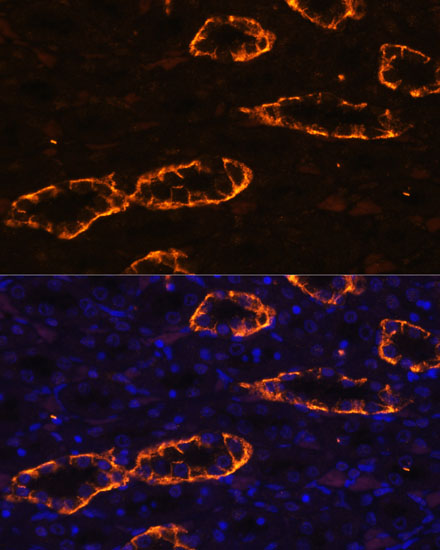 Anti-AQP3 Antibody (CAB2838)