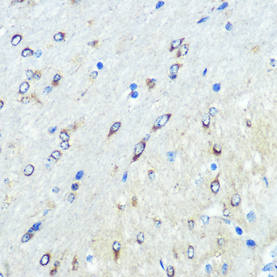 Anti-FUT4 Antibody (CAB16320)