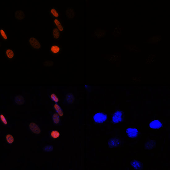 Anti-Acetyl-Histone H3-K56 Antibody (CAB7256)