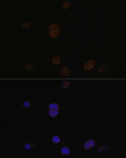 Anti-RCVRN Antibody (CAB6404)