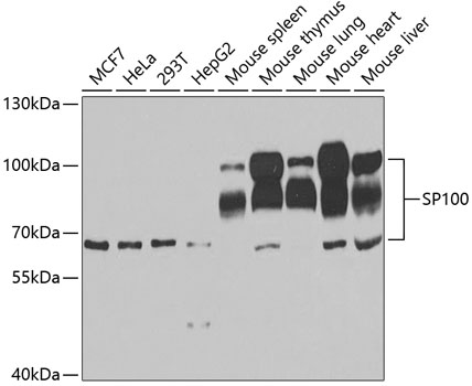 Anti-SP100 Antibody (CAB5851)