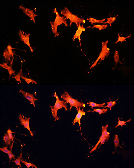 Anti-SIRT2 Antibody (CAB12575)