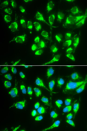 Anti-SLC22A5 Antibody (CAB1676)