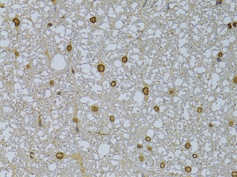 Anti-HDGFRP3 Polyclonal Antibody (CAB8815)