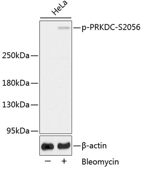 Anti-Phospho-PRKDC-S2056 Antibody (CABP0621)