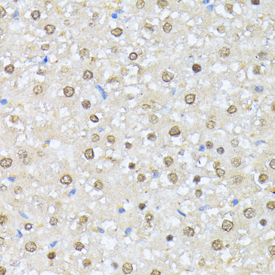 Anti-CKII Alpha Antibody (CAB1014)