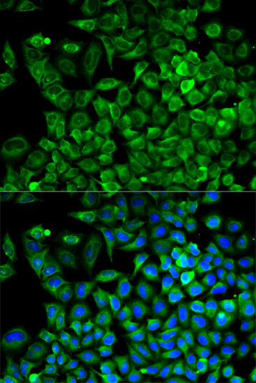 Anti-ALDOA Antibody (CAB1142)