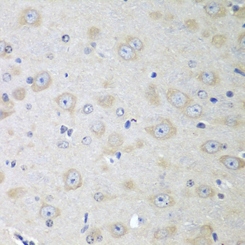 Anti-YES1 Antibody (CAB0628)