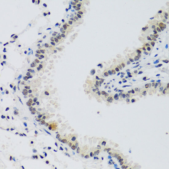 Anti-Cyclin E2 Antibody (CAB4272)