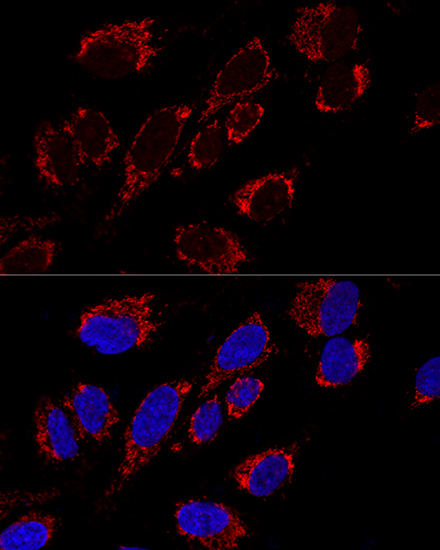 Anti-MRPS31 Antibody (CAB12923)